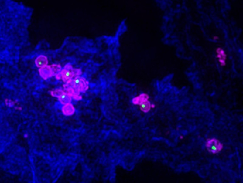 M.jpg (70.82 KiB) Преглеждано 9093 пъти Макрофаги заразени с Francisella novicida (magenta) произвеждащи нано-копие . (зеленото)