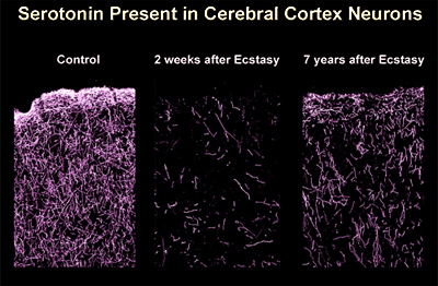 serotonin-in-cerebral-cortex-neurons.jpg